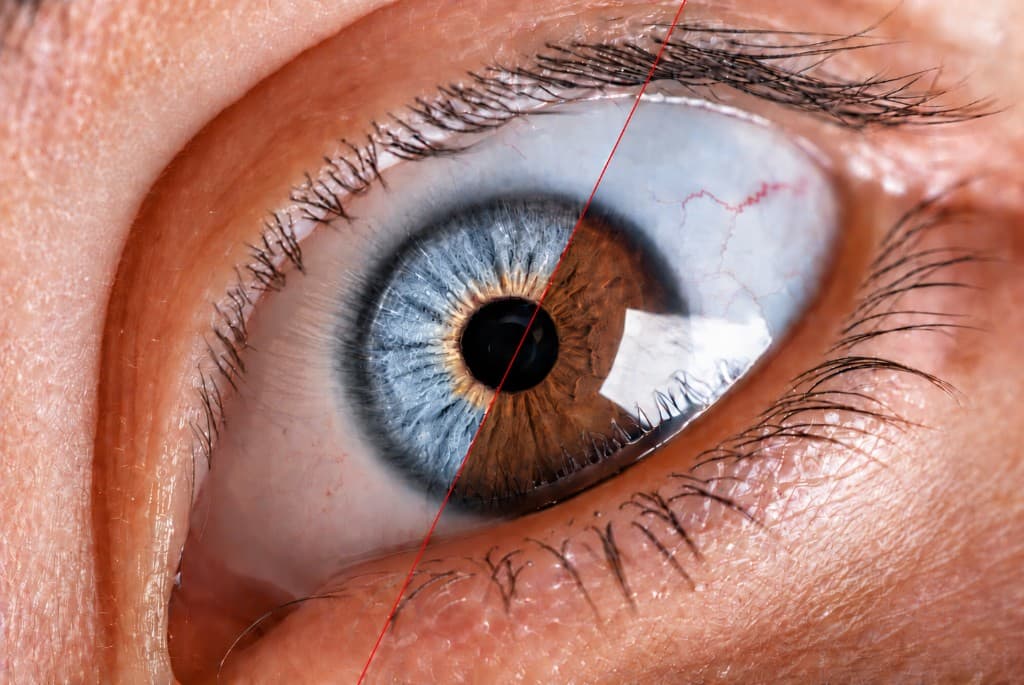 Eye color change — KOLOR Congress